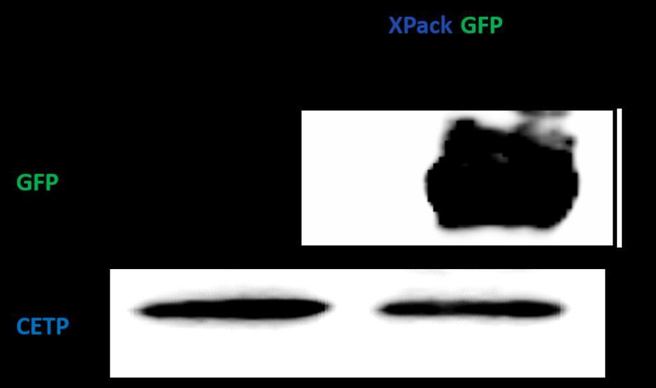 System Biosciences (SBI) User Manual Fig. 4: Western blot on exosomes secreted from XPack-GFP transfected HEK293T cells.
