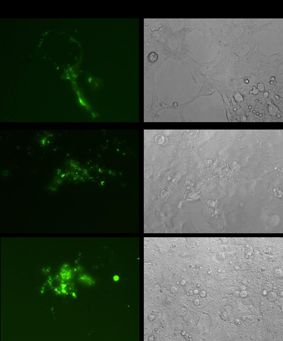 System Biosciences (SBI) User Manual Fig. 6: Exosomes from HEK293T cells transfected with XPack- GFP deliver GFP to target cells, as analyzed by fluorescence microscopy.