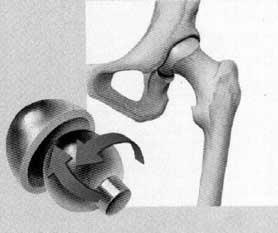 Ball and Socket Joint Articular Cartilage Spreads loads over a