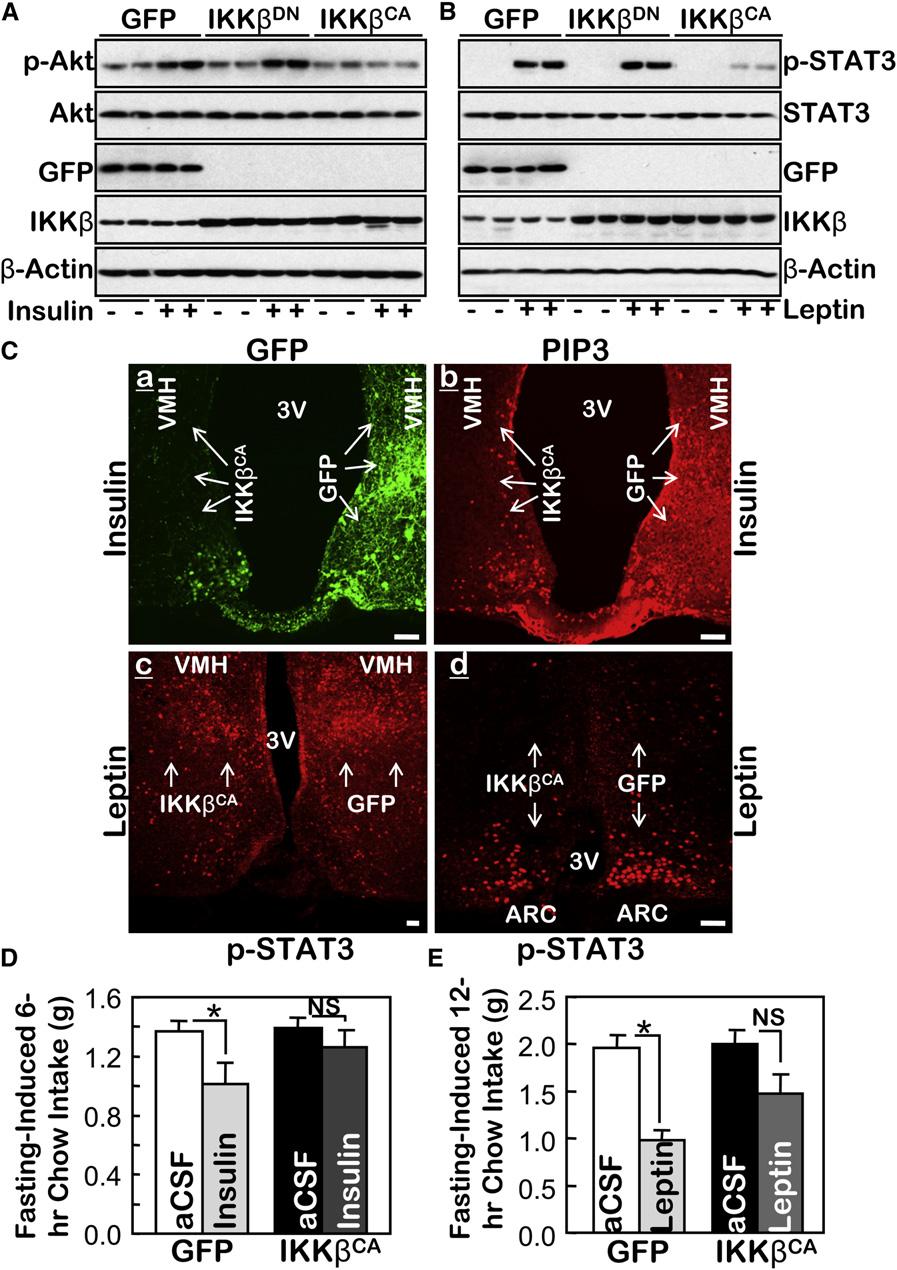 Figure 4. IKKb/NF-kB in the MBH Mediates Central Insulin and Leptin Resistance (A and B) An adenovirus was injected to deliver IKKb CA, IKKb DN, or GFP to both MBH sides of normal C57BL/6 mice.