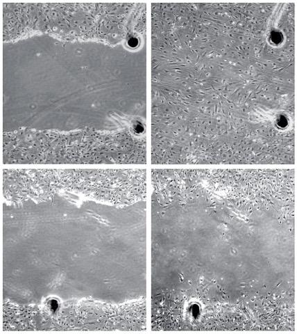 Effect of Platelet-Derived Growth Factor (PDGF) on Cells PDGF: + Wt. Fibroblasts PDGFR+ Mut.