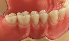 TOP FUNCTION PERFECT RESULT The Ceramill Full Denture System fabricates full dentures in a working process designed according to dental technology logic that