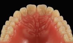of the set of teeth with automatic set-up _ Quick, easy customisation and