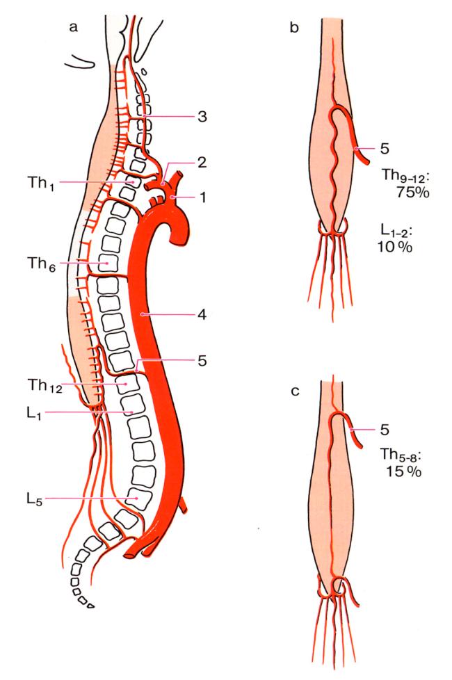 Puncture Spinal Anaesthesia o Dura Mater Spinalis Epidural Space ----------------------------- Epidural