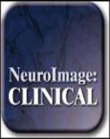 NeuroImage: Clinical 2 (2013) 291 302 Contents lists available at ScienceDirect NeuroImage: Clinical journal homepage: www.elsevier.