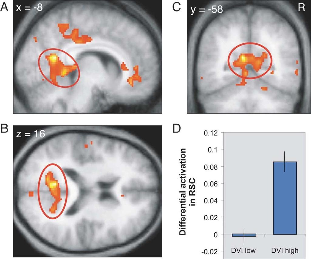 94 J.S. Winston et al. / NeuroImage 20 (2003) 84 97 Fig. 7. Retrosplenial cortex shows interaction between task and intensity.