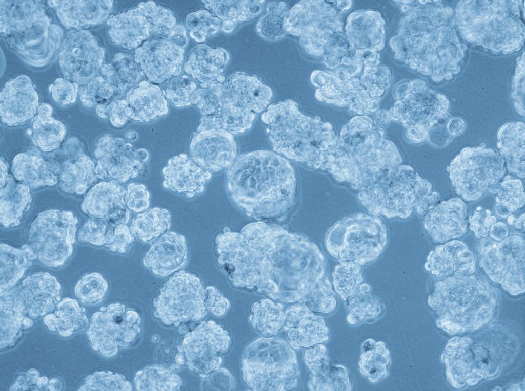 Forty thousand MCF-7 cells per well (10,000/ml) were plated in triplicate in the PromoCell Cancer Stem Cell Medium using 6-well suspension culture plates.