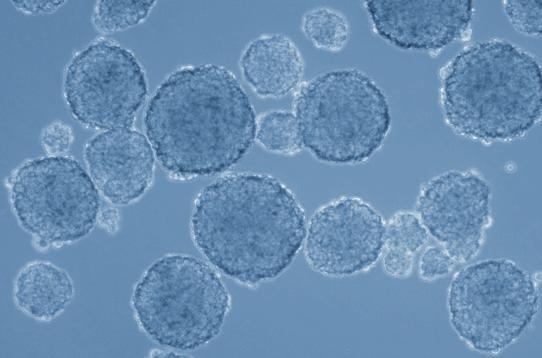 4 Application Note - Tumorsphere Culture of Cancer Stem Cells (CSC) CSC are self-sustaining and largely resistant to anoikis, the term for apoptosis induced by the detachment of adherently growing