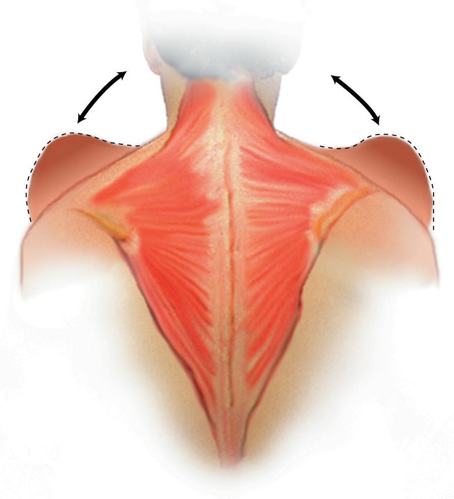 Action of the Trapezius Muscles Fig. 1-46.
