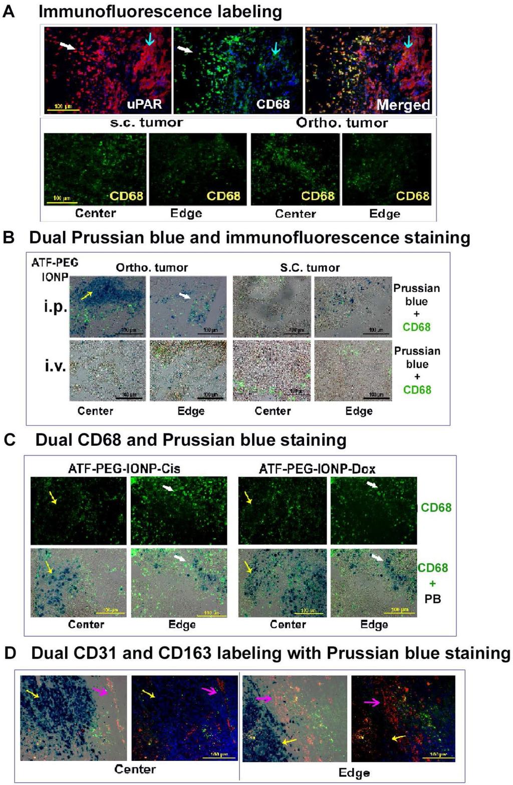 1698 Figure 5. Histological analysis of intratumoral delivery mechanism and distribution of upar targeted nanoparticles following i.p. delivery. A, Immunofluorescence labeling identifies upar expressing cells in the PANC02 tumors.