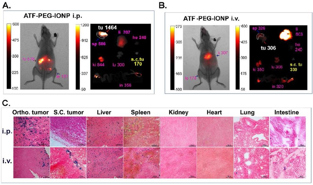 1695 Figure 3. Comparison of targeted delivery of upar targeted IONPs into orthotopic and s.c. tumors following i.p. or i.v. delivery by optical imaging and histological analysis.
