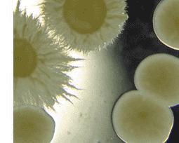 Cryptococcus neoformans yeast