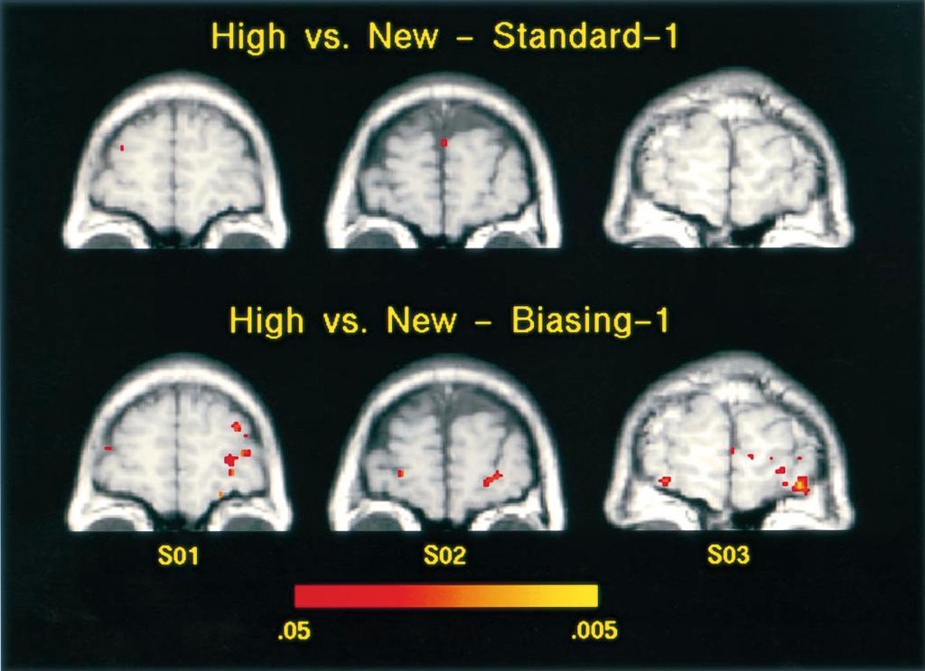 Prefrontal cortex and recognition memory 1997 Fig. 5 Functional activation maps for one anterior section from each of three participants (S01, S02 and S03).