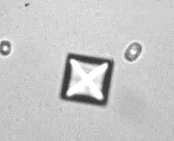 Calcium oxalate dihydrate crystals may develop after collection in stored urine samples with or without refrigeration or in
