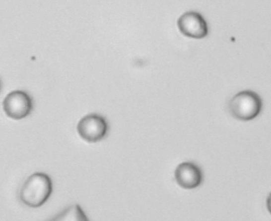 lipid droplets - Erythrocytes are all the same size, and some may be crenated. Lipid droplets are variably sized, refractile spheres.
