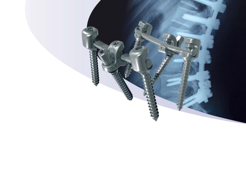 Unique, pre-assembled screws - Pre-assembled locking components - no risk of dropping parts or cross threading - Integrated multiaxial connections A new standard: the LDR flattened rod - Variable