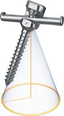 The Standard screw provides 20 of angulation in a medial-lateral direction and the Alpha, 20 of angulation in all directions for 40 total.
