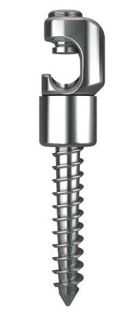 Because part of the threaded screw will not penetrate the bone, it is important to select a screw somewhat longer than would otherwise be employed (approximately equal