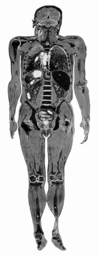 muscles, to the skeleton, generally with the same number of muscles and bones on