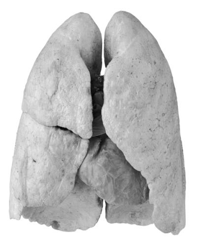 19 Lungs Heart    20 Organs  