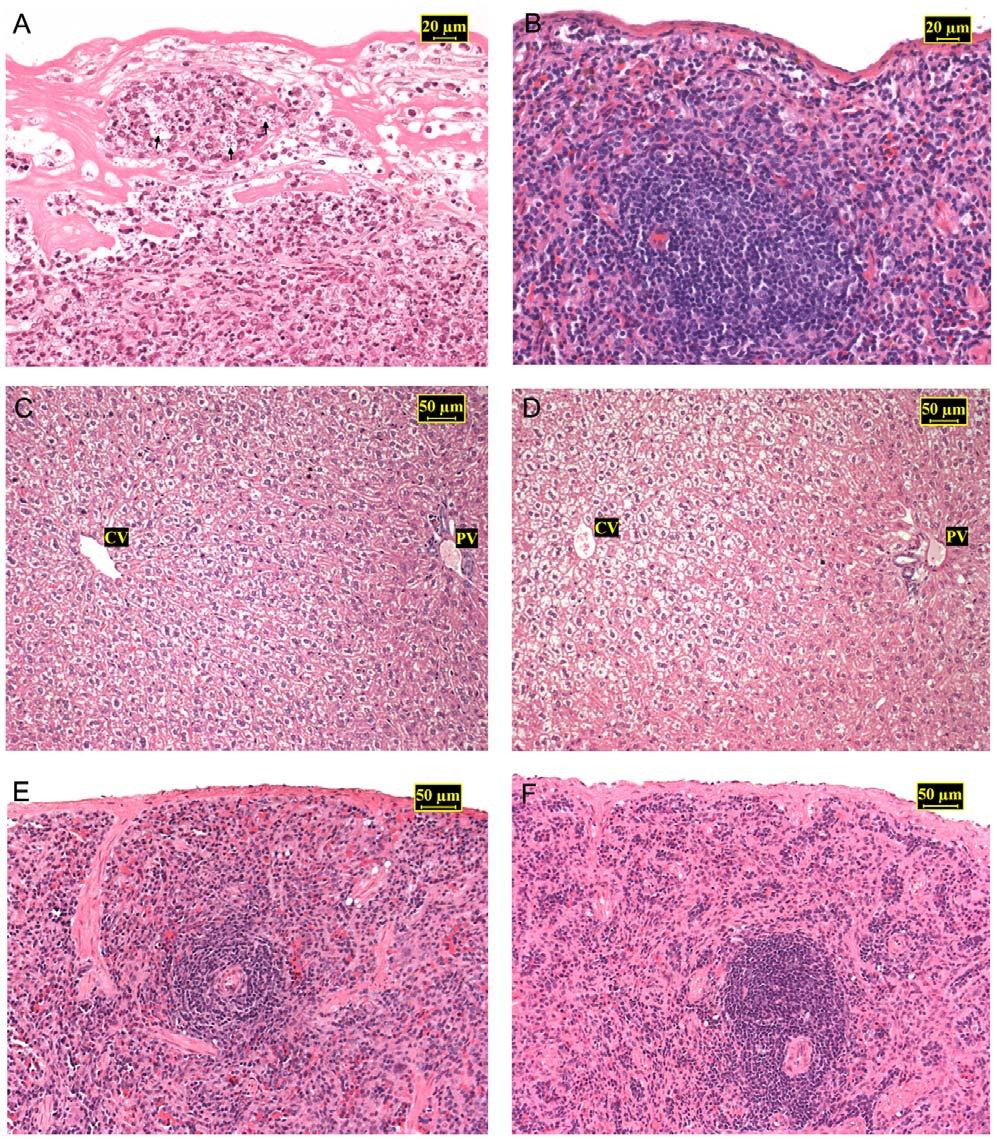 Figure 5. Photomicrographs of spleen and liver sections from Leishmania braziliensis or L. infantum infected rodents stained with haematoxylin-eosin. A: L.