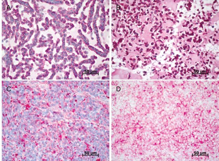 SW480 primary tumours were also HPA negative, whereas HT29 tumours showed a heterogeneous staining pattern within a single tumour, with both HPA-negative and - positive areas.