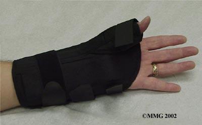 By resting the wrist extensor tendons and the thumb muscles, it allows the area to begin healing.