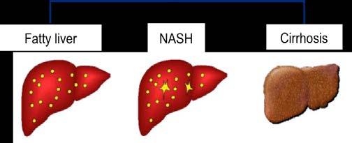 with insulin resistance, but the mechanisms are unclear (see Nonalcoholic Fatty Liver Disease, Pathogenesis) (41).