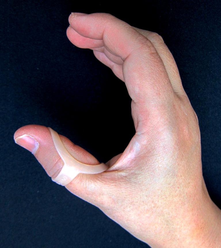 Avoid tight fitting splints, check skin carefully for pressure areas before wearing overnight.