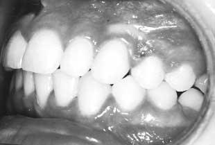 American Journal of Orthodontics and Dentofacial Orthopedics Sandler, Atkinson, and Murray 425