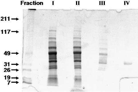 27148 Endopolyphosphatases for Inorganic Polyphosphate FIG. 1.Analysis of PPN by SDS-PAGE.