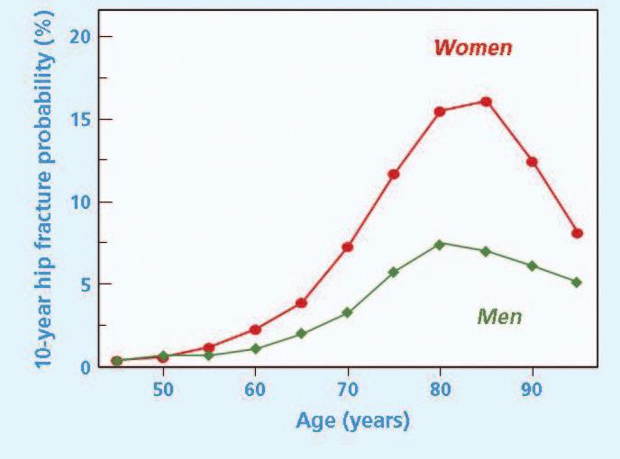 8 Figure 4 Fracture probability is age, BMD and gender specific Instead of applying the same relative risk for a decrease in BMD across all ages, the FRAX tool allows a more individualised