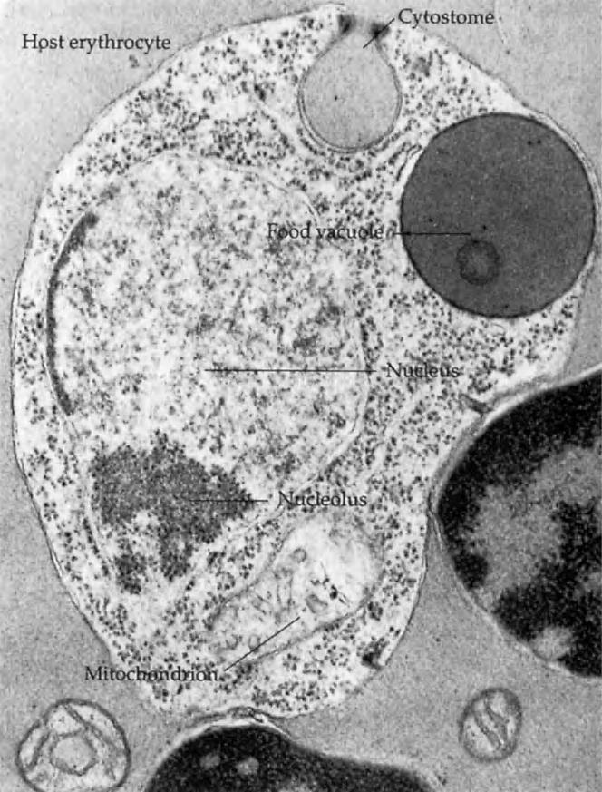 122 7. BLOOD AND TISSUE PROTOZOA II: HUMAN MALARIA FIGURE 7-4 An erythrocyctic trophozoite of Plasmodium gallinaceum showing host cell hemoglobin being ingested at cytostome site.