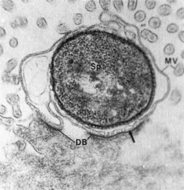 CRYPTOSPORIDIUM PARVUM 147 FIGURE 8-5 Sporozoite (sp) of Cryptosporidium parvum surrounded by intestinal microvilli