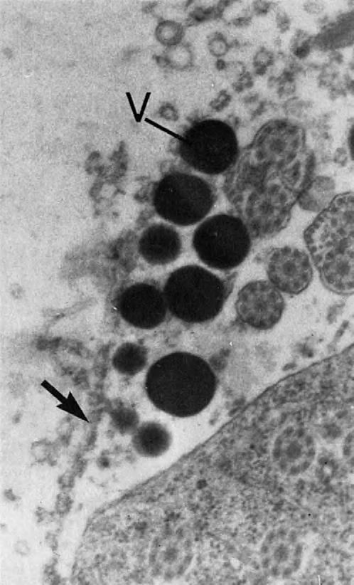STRUCTURE OF ADULT 165 FIGURE 9-13 Transmission electron micrograph of a forming egg shell of a digenetic trematode.