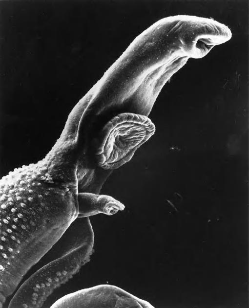 Note female worm in gynaecophoric canal.