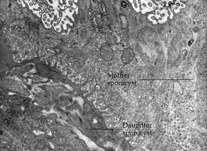 VARIATIONS 205 FIGURE 11-8 Transmission electron micrograph of the tegument of a mother sporocyst with enclosed daughter sporocyst of Schistosoma mansoni.