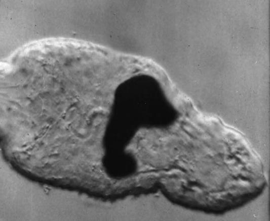 208 11. BLOOD FLUKES FIGURE 11-11 Light micrograph of a feeding schistosomule. Note the black pigment derived from host hemoglobin in the digestive tract. lateral spine (Fig. 9-16).