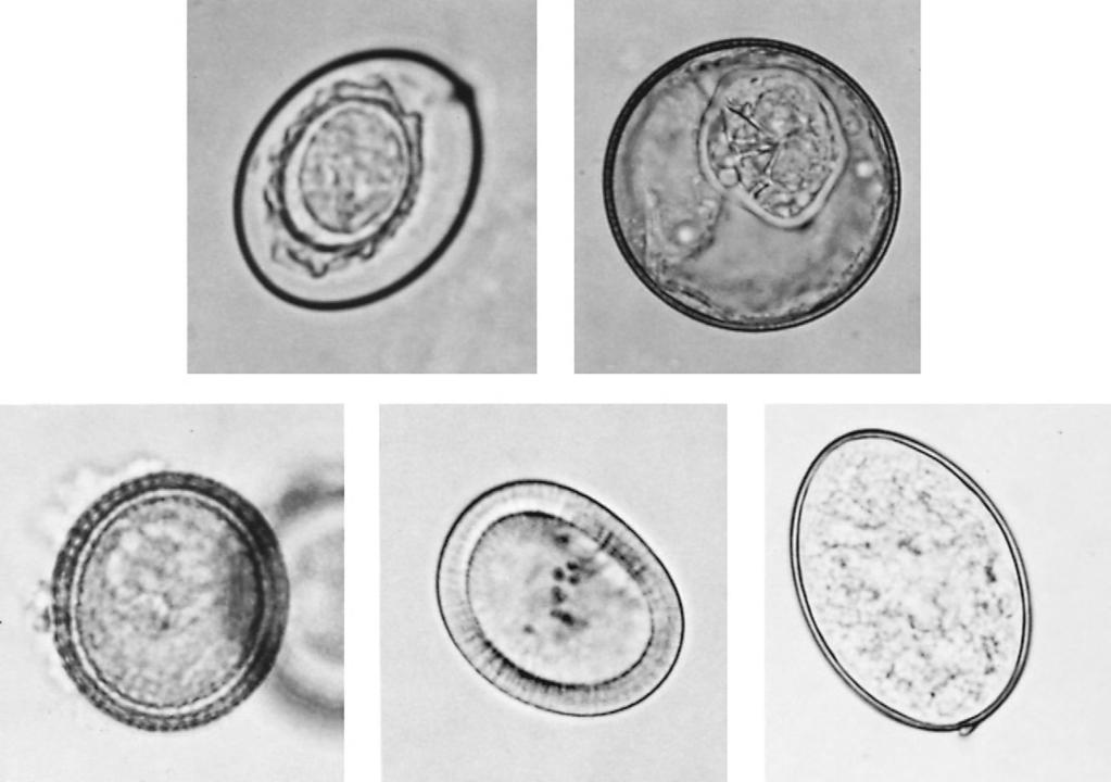 234 12. GENERAL CHARACTERISTICS OF THE CESTODA (a) (b) (c) (d) (e) FIGURE 12-13 Some cestode eggs. (a) Hymenolepis nana: the dwarf tapeworm of humans, rats, and mice.