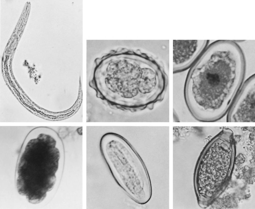 282 15. GENERAL CHARACTERISTICS OF THE NEMATODA (a) (b) (c) (d) (e) (f) FIGURE 15-13 Some nematode eggs and larvae. (a) Strongyloides stercoralis rhabditiform larva.