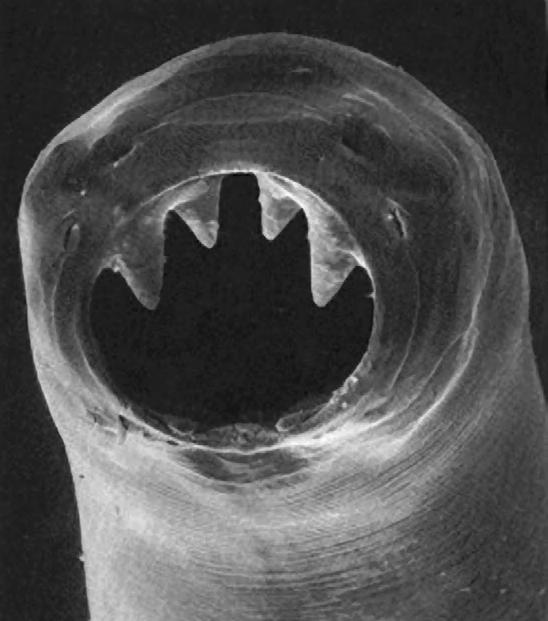 312 16. INTESTINAL NEMATODES FIGURE 16-14 Scanning electron micrograph of Ancylostoma duodenale buccal area. Positive diagnosis requires identification of eggs in the feces.