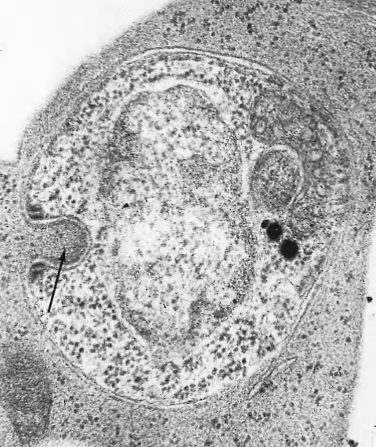 ENCYSTATION 47 FIGURE 3-11 A uninucleate trophozoite of Plasmodium cathemerium ingesting host cell, cytostome (arrow). where they are believed to serve as anchors.