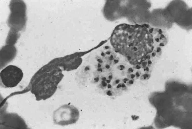 FIGURE 6-9 Amastigotes of Leishmania sp.