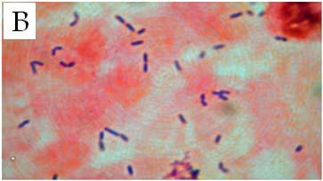 Fig. 1 (A) adhesion of Bifidobacterium longum BB536 and (B) Bifidobacteirum pseudocatenulatum G4 to human epithilum cell.