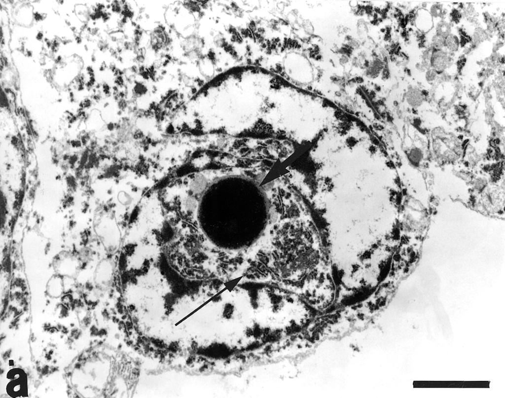 Folia Morphol., 2006, Vol. 65, No. 3 Figure 3. Electron micrographs of two dark pinealocytes (A and B).