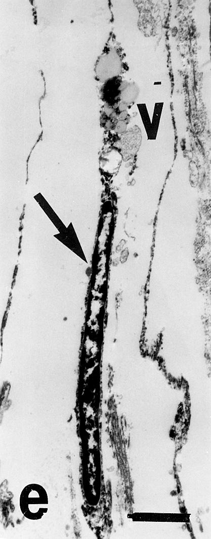 Electron micrograph of one type III cell (arrow) with vacuoles (V) at one