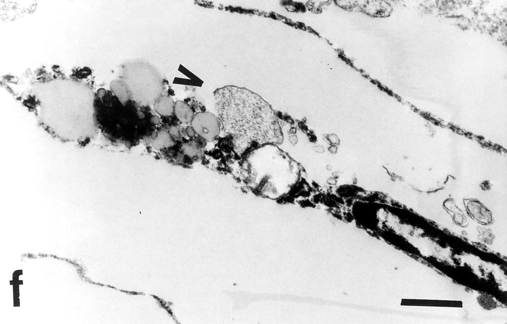 This end of the cell with vacuoles (V) is shown at a higher magnification