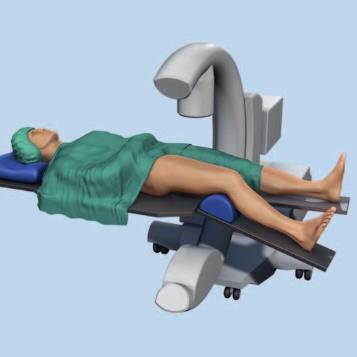 Preparation 2 Position the patient Position the patient supine on a radiolucent table. The leg should be freely movable. The contralateral leg can be placed in an obstetric leg holder.