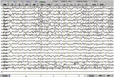 18 We use an EEG-2130 digit electroencephalogram to record 20 minutes long EEG under the subjects of quiet, waking, eye closure state. The sampling rate in this experiment was 200 Hz.