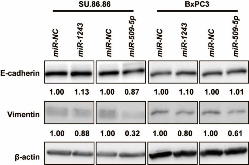 Supplementary Figure S3. mir-509-5p and mir-1243 did not induce an MET phenotype in a couple of pancreatic cancer cell lines.